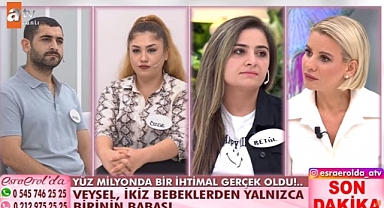 İKİZLERDEN BİRİ FARKLI BABAYA AİT TIP DÜNYASI ŞOKTA