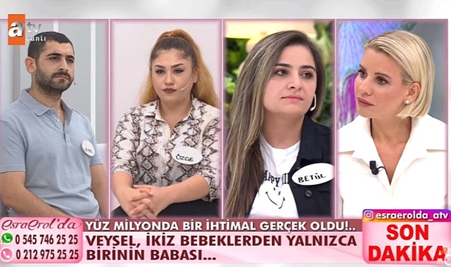 İKİZLERDEN BİRİ FARKLI BABAYA AİT TIP DÜNYASI ŞOKTA